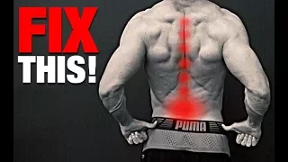 How to Fix a Bulging Disc (NO SURGERY!)