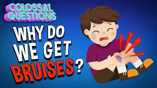 Why Do We Get Bruises? | COLOSSAL QUESTIONS