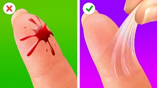 LIFE-SAVING HACKS FOR EVERY OCCASION || 5-Minute Homemade Remedies!