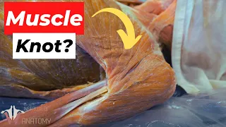 What EXACTLY Are Muscle Knots? And Why Do They Happen?