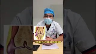 膝關節#囊腫可以徒手弄沒嗎？