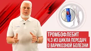 тромбофлебит и варикоз на ногах