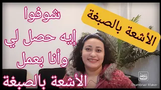 شوفوا إيه حصل وانا بعمل أشعة مقطعية بالصبغة