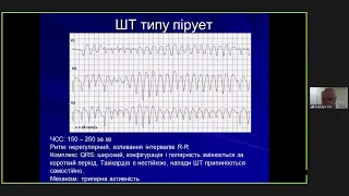 Тахікардії з широкими комплексами QRS. Диференційна діагностика. 31.10.22р.