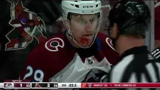 Nathan MacKinnon Bloodied After Highstick From Dyson Mayo