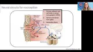 Café Scientifique — The Mystery of Persistent Pain After Injury — Dr. Vivianne Tawfik, MD, PhD