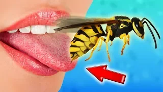 What happens if a Wasp bites a Person's Tongue? I was stung in the Tongue by a Wasp