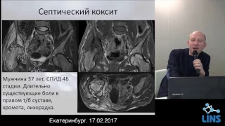 Цориев А.Э. Поражения костной-суставной системы при СПИДе