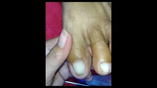 Nailed It/Pedicure Part 5