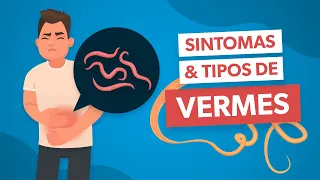 Sintomas de VERMES que você NÃO PODE ignorar!