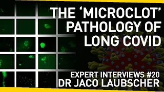 The 'Microclot' Pathology of Long Covid | With Dr Jaco Laubscher