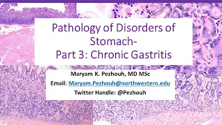 Part 3  Pathology of Gastric Disorders   Chronic Gastritis