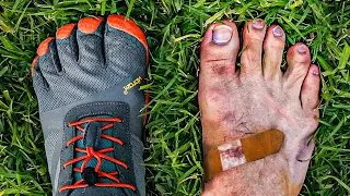 100,000 Steps in Barefoot Shoes...Why I Had To Stop