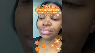 Love This Cupid's Bow Transformation 🧡