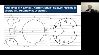 Атипичный паркинсонизм с психическими расстройствами