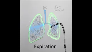 Pneumothorax Treatment Animation (variation 7) #shorts #medical