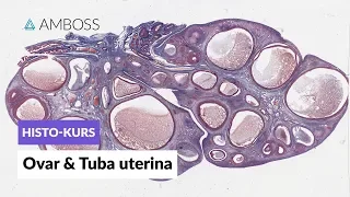 Histologie Ovar und Tuba uterina - Mikroskopische Anatomie - AMBOSS Video