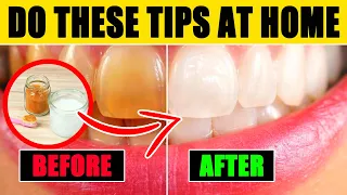 10 естественных методов отбеливания зубов