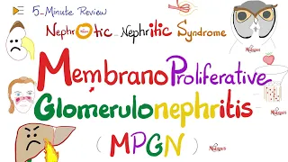 Membranoproliferative Glomerulonephritis (Type 1 and 2) | MPGN-I & MPGN-II | Nephrology