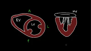 Anatomy, ECG & Acute MI- Dr John Roberts