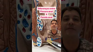 Qual a diferença entre fissura anal x fístula anal? - Dr. Guy Gama - Proctologista em Maceió