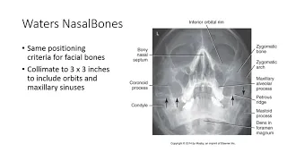 Radiographic Positioning of the Nasal Bones