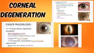corneal degeneration |classification | symptoms | treatment | ophthalmology | English