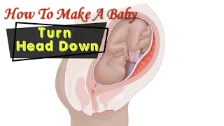 How to make a Breech or Transverse baby Turn Head Down // #pregnancy  #baby