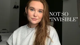 The unspoken struggle of living with an “invisible” illness | Living with endometriosis