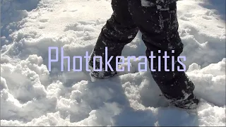 Photokeratitis-[Schrodinger Productions]