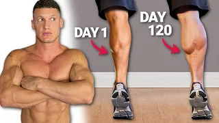 I trained calves EVERY DAY for 120 DAYS | Ruptured Achilles’ Tendon Recovery
