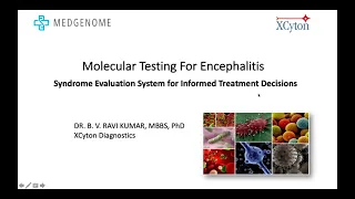 MedGenome Micra Webinar- World Encephalitis Day 2021