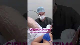 Ninfoplastia feita em consultório, sem necessidade de acompanhante e sem custos hospitalares