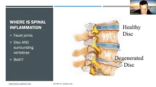 Dr. Jeffrey Gross, Neurosurgeon talks about Regenerative Interventions in the Spine
