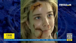 "Я жива!": история девушки, которой чудом удалось спастись из пылающего ТЦ в Кременчуге | FREEДОМ