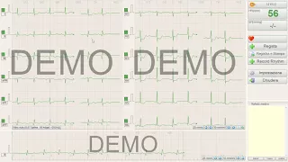 CARDIO POINT ECG E SDS