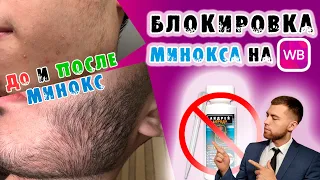 Блокировка минокса на WB / Минокс До и После / Андрей Борода / Выпуск № 16 "Как отрастить бороду"