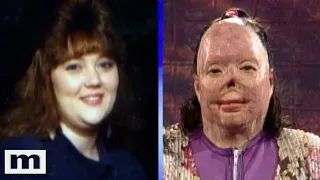 Woman Survives Being Burned Alive! | The Maury Show