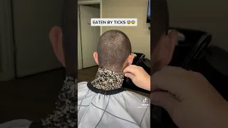 Barber Cuts Off Ticks!!!