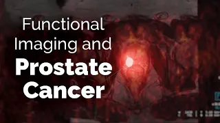 Functional Imaging and Recurring Prostate Cancer