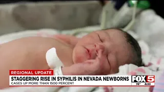 Staggering rise in syphilis in Nevada newborns