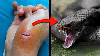 10 Most Venomous Snakes In The World!