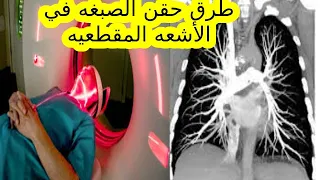 طرق حقن الصبغه/الماده الملونة في الأشعه المقطعيه