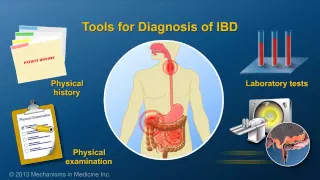 Diagnosing IBD