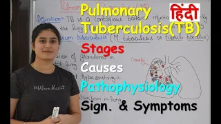 Pulmonary Tuberculosis in Hindi | Stages | Causes | Pathophysiology | Sign. & Symptoms