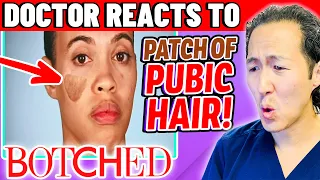 Plastic Surgeon Reacts to BOTCHED: Pubic Hair On Her Face!