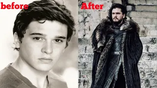 Kit harington transformation (2008-2022) #shorts #gameofthrones