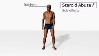 Side Effects of Steroids Abuse