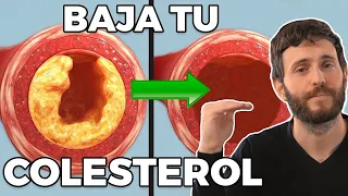 Baja Tu Colesterol Y Limpia Tus Arterias Así