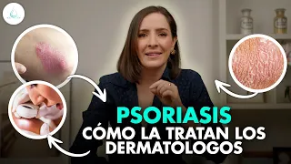 🔴 TRATAMIENTO para la PSORIASIS ¿Tiene CURA? | Te lo EXPLICO TODO @drapilarochoa - Dermatologa